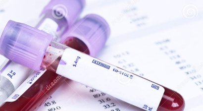 Behandlung Hämatologischer Grunderkrankungen  