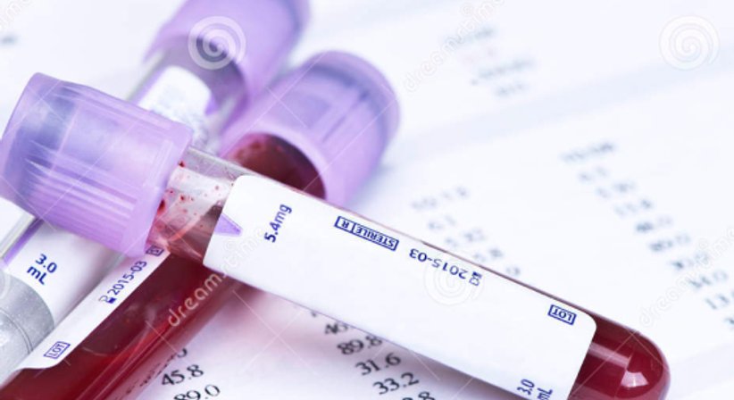 Behandlung Hämatologischer Grunderkrankungen   - OA Dr. Wolfgang Fiebiger - Internist Wien 1090