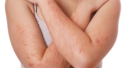 Persönlichkeitsstörung