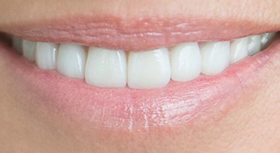 Ästhetische Zahnheilkunde