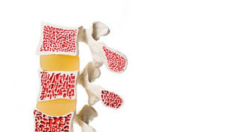 Knochendichtemessung - Dr. Michael Reisegger - Radiologe Mödling 2340