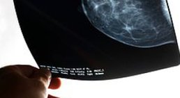 Dr. Michael Reisegger - Radiologe Mödling 2340