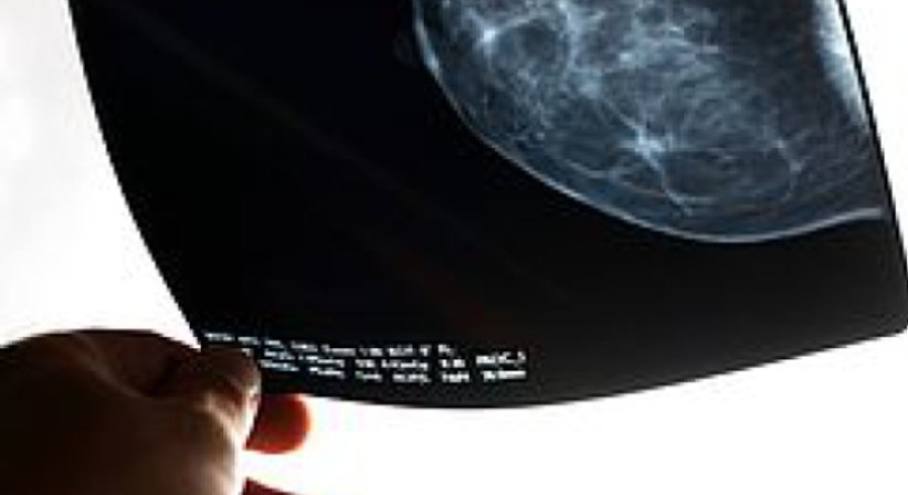 Mammographie - Dr. Michael Reisegger - Radiologe Mödling 2340