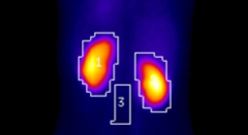 Nuklearmedizin - Dr. Michael Reisegger - Radiologe Mödling 2340