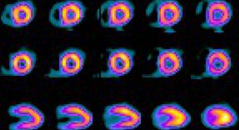 Nuklearmedizin - Dr. Michael Reisegger - Radiologe Mödling 2340