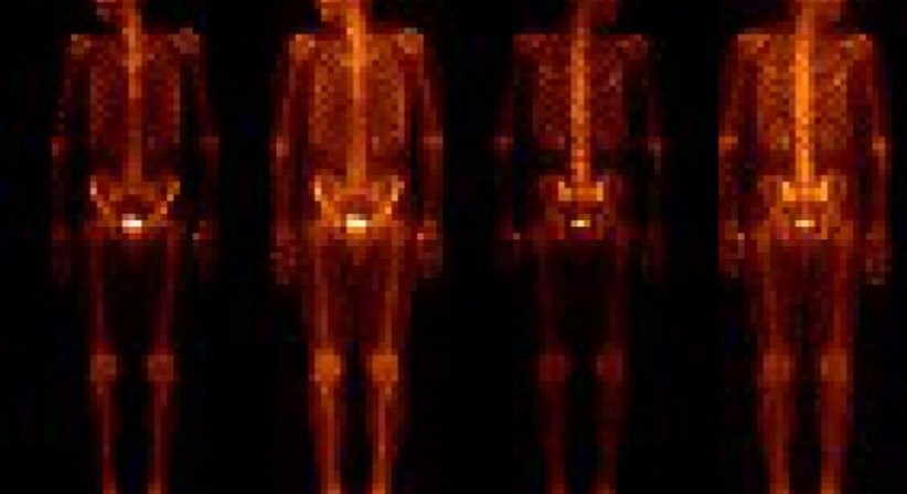 Nuklearmedizin - Dr. Michael Reisegger - Radiologe Mödling 2340