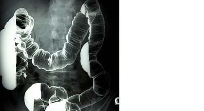 Röntgen - Dr. Michael Reisegger - Radiologe Mödling 2340