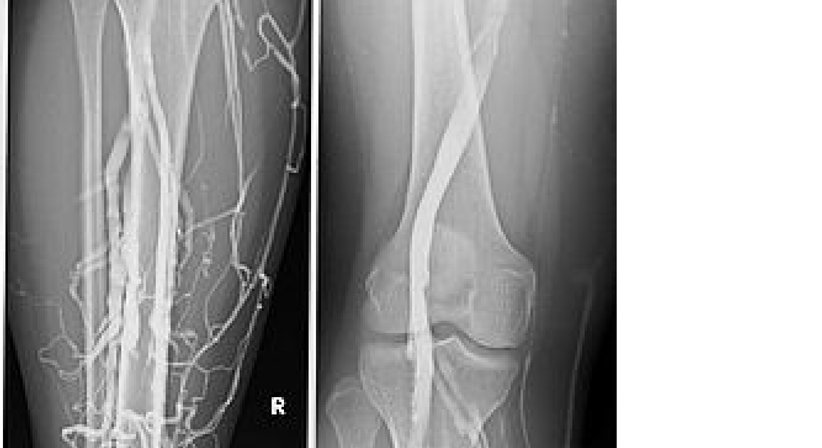 Röntgen - Dr. Michael Reisegger - Radiologe Mödling 2340