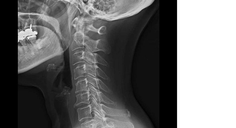 Röntgen - Dr. Michael Reisegger - Radiologe Mödling 2340