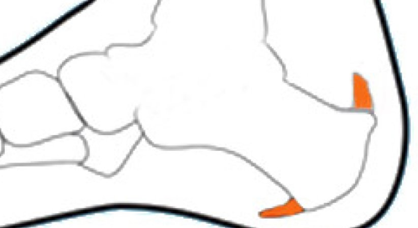 Röntgenschwachbestrahlung ab Mai 2017 - Dr. Michael Reisegger - Radiologe Mödling 2340