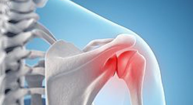 Röntgenschwachbestrahlung ab Mai 2017 - Dr. Michael Reisegger - Radiologe Mödling 2340