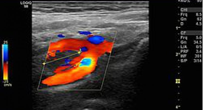 Ultraschall - Dr. Michael Reisegger - Radiologe Mödling 2340
