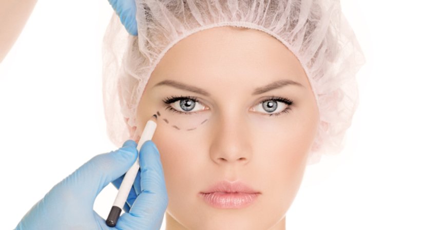 Facelift - Univ.Doz. Dr. Rafic Kuzbari - Plastischer Chirurg Wien 1010