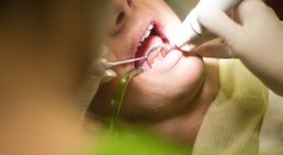 Professionelle Mundhygiene -