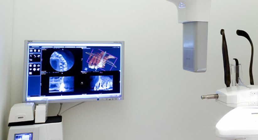 Implantologie - Univ. Prof. Priv.-Doz. Dr.med.univ. Dr.med.dent. Clemens Klug - Kieferchirurg Wien 1190