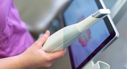 3D-Scanner statt Abdruck mit Paste