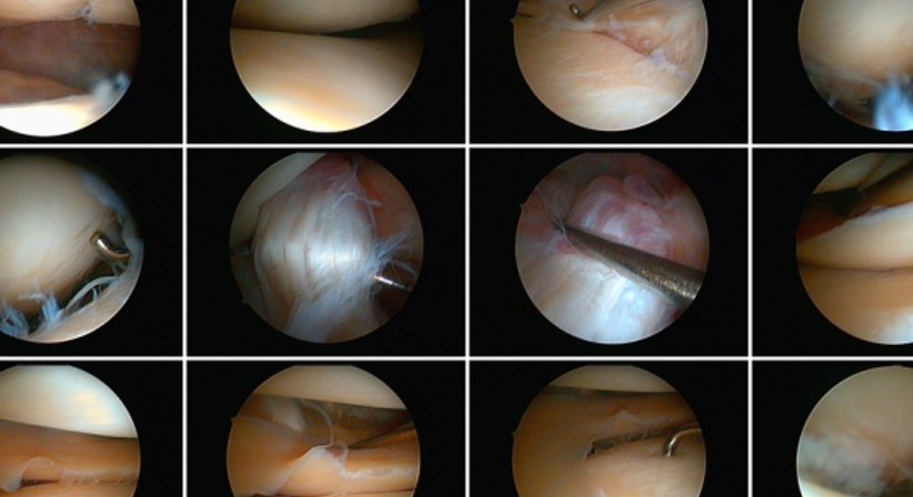 Arthroskopie (Sprunggelenk, Knie) - OA Dr. Thomas Czurda - Orthopäde Wien 1080