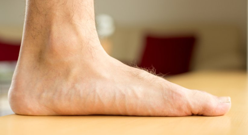 Plattfuß - OA Dr. Thomas Czurda - Orthopäde Wien 1080