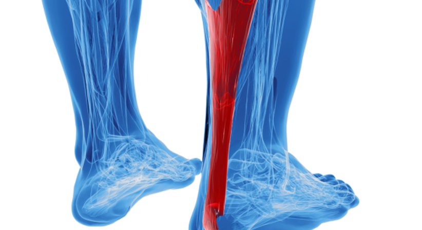 Sehnenpathologien - OA Dr. Thomas Czurda - Orthopäde Wien 1080