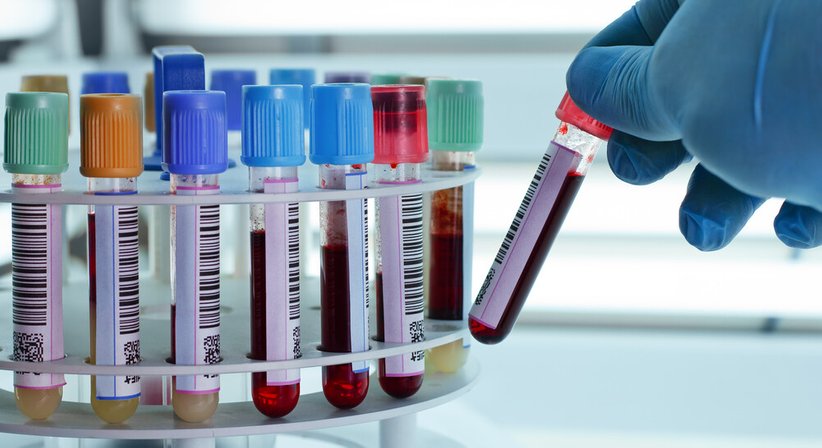 PRP-Therapie (Vampirlift) - Dr. Jennifer Kager - Allgemeinchirurgin/Viszeralchirurgin Wien 1010