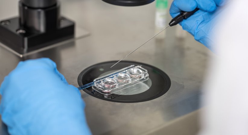 Insemination - OÄ Dr. Sarwenaz Mahrouzadeh-Muqolli - Frauenärztin Wien 1010