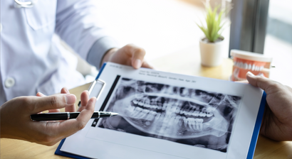 Behandlung gegen Zahnfleischrückgang