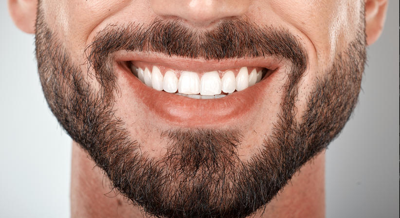 Zahnbleaching - Dr. med. dent. David Ungvari - Zahnarzt Graz 8010