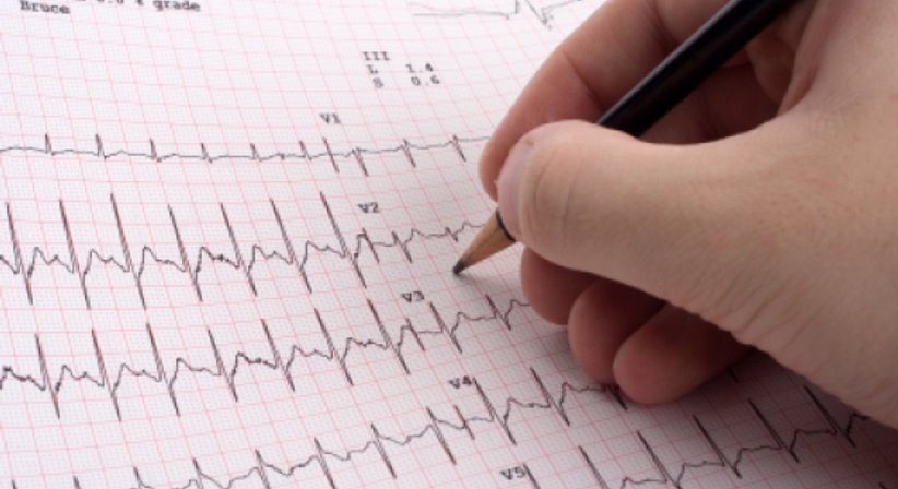 Elektrokardiogramm - Prof. PD Mag. Dr. Lukas Fiedler, FESC - Internist Wien 1230