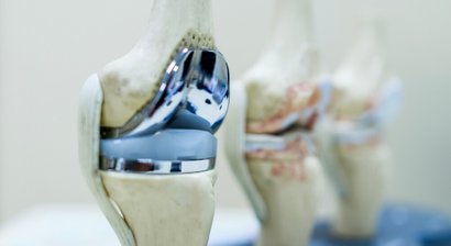 Revisionsoperation im Schulter- und Kniebereich