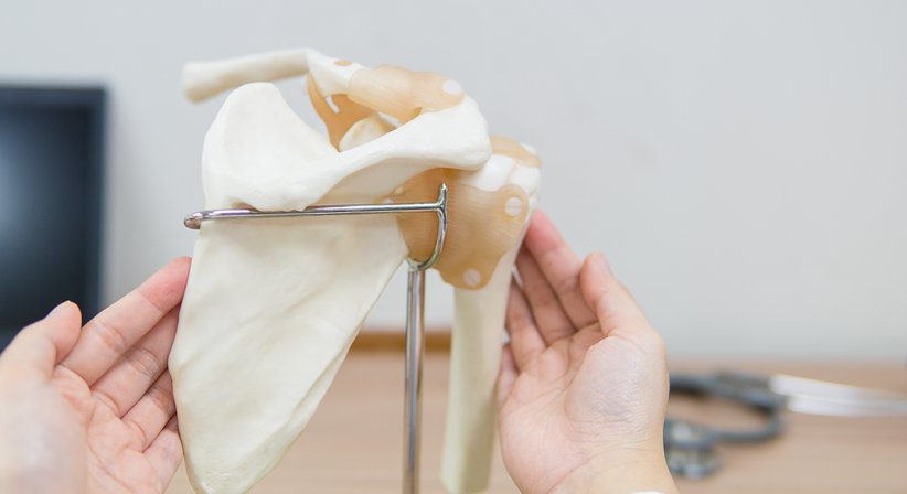 Schulterarthrose (Omarthrose) - Dr. René Könighofer - Orthopäde Graz 8010