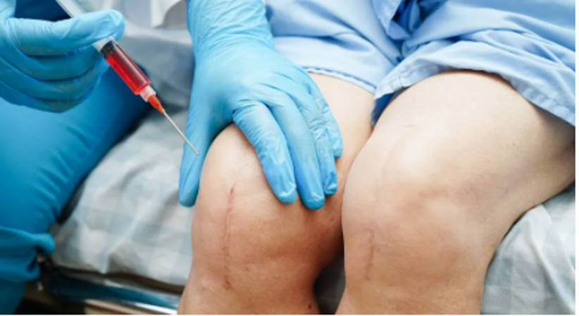 Regenerative Medizin - OA Priv.-Doz. DDr. Leo Pauzenberger, MBA FRCS FFSEM - Orthopäde Mödling 2340