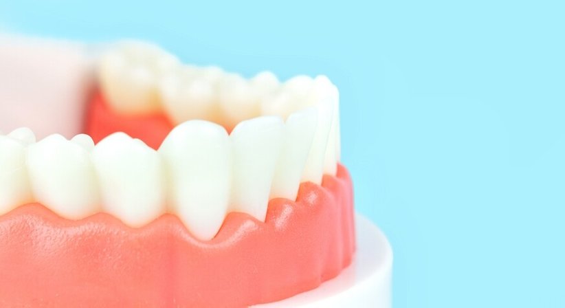 Implantatprothetik - Zahnklinik Wien Döbling -  Wien 1190