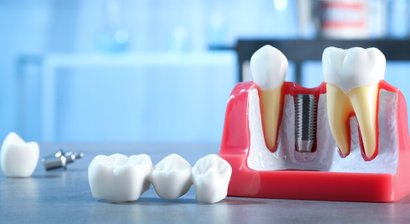 Kronen- und Brückenversorgung - metallfrei mit Zirkonkeramik