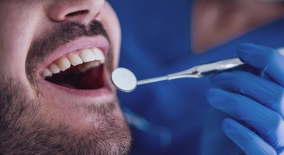 Professionelle Mundhygiene