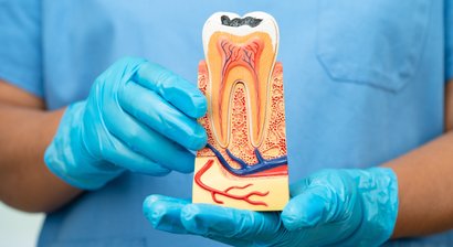 Wurzelkanalbehandlung