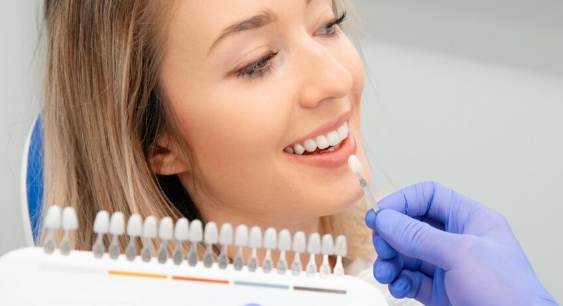 Veneers (keramische Verblendschalen) - Zahnklinik Wien Döbling -  Wien 1190