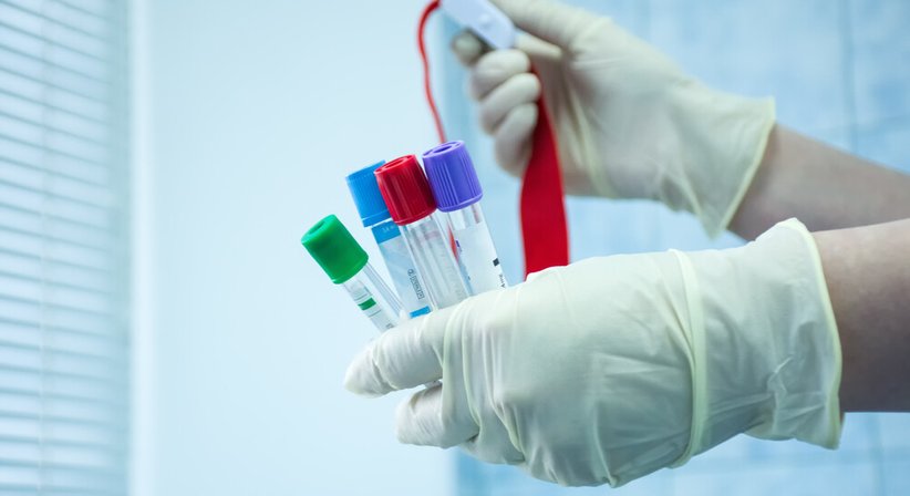 Fettstoffwechsel - OA Dr. David Weidenauer - Kardiologe Wien 1090