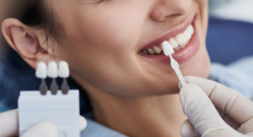 -Keramische Resaurationen - Dr. medic stom. Markiel Haimov - Zahnarzt Wien 1220