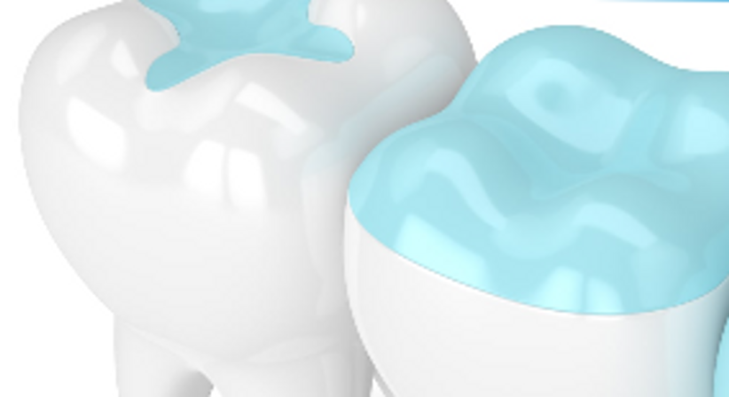 -Hochwertige Füllungen - Dr. medic stom. Markiel Haimov - Zahnarzt Wien 1220