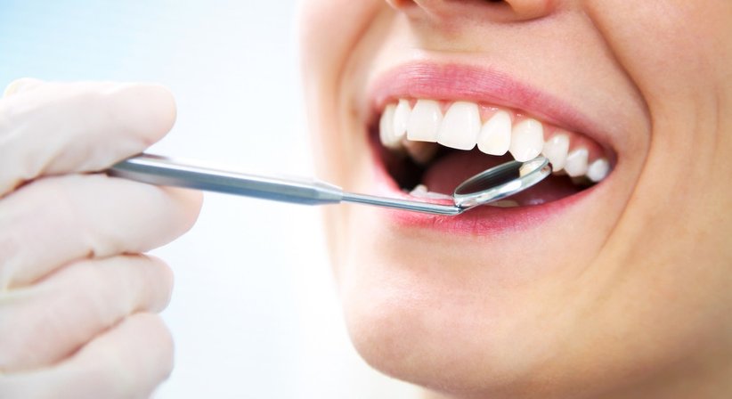 Kompositfüllungen - Dr. Philipp Kaiser, MMSc LLM - Zahnarzt Draßburg 7021