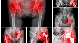 Prim. Dr. Werner Anderl - Orthopäde Mödling 2340