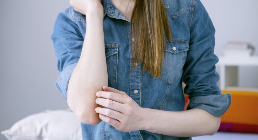 Neurodermitis - Dr. Hannes Trattner - Hautarzt Wien 1090