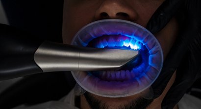 Intraoralscanner