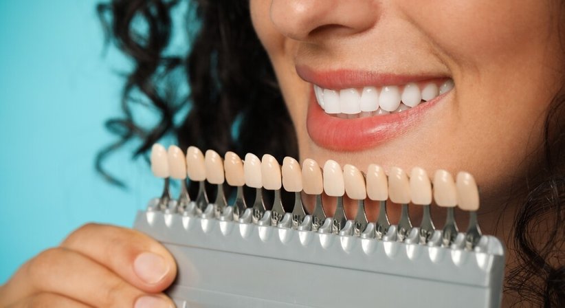 Kronen & Veneers - Dr. Marielle Bauer - Zahnärztin Wien 1020