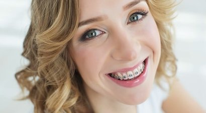 Festsitzende Zahnspange