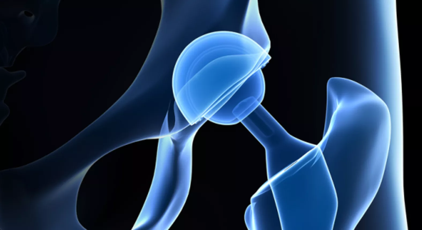 Prothetik - Prim. Dr. Wolfgang Kaltenbrunner - Orthopäde Wien 1040