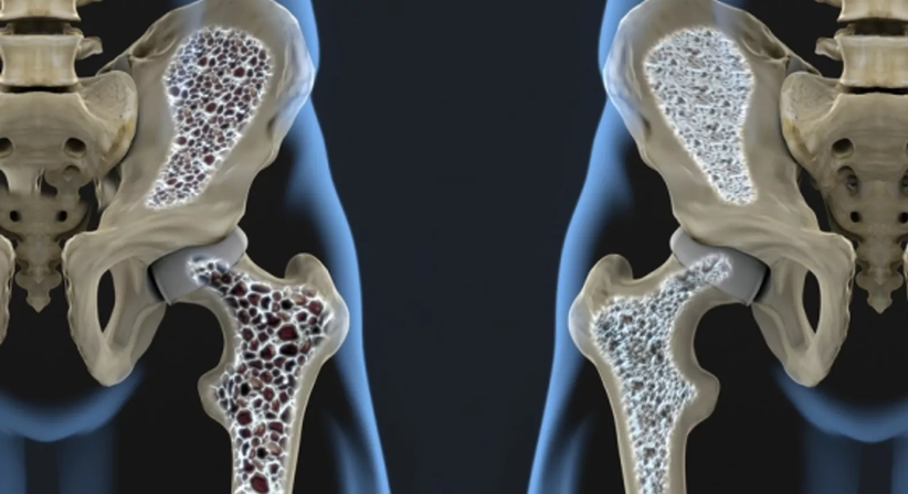 Hüftgelenksnahe Frakturversorgung - Prim. Dr. Wolfgang Kaltenbrunner - Orthopäde Wien 1040