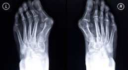 OA Dr. Günter Stolz - Orthopäde Wien 1130
