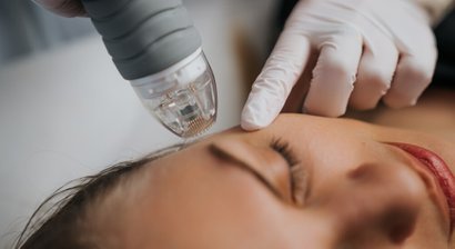 Radiofrequenz-Needling mit DoubleTite oder Potenza