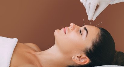 Akupunktur – Sanfte Heilung durch die Kraft der Nadeln